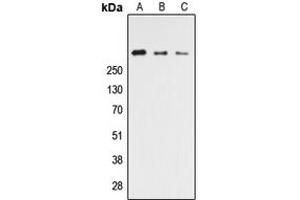 Western blot analysis of CELSR3 expression in HEK293T (A), NS-1 (B), PC12 (C) whole cell lysates. (CELSR3 抗体  (C-Term))