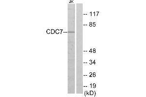 Western blot analysis of extracts from Jurkat cells, using CDC7 antibody. (CDC7 抗体  (Internal Region))