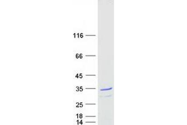 C14orf166 Protein (Myc-DYKDDDDK Tag)