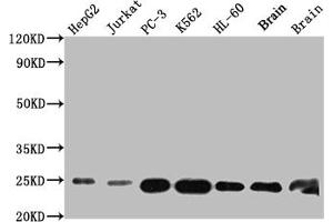 Western Blot Positive WB detected in: HepG2 whole cell lysate, Jurkat whole cell lysate, PC-3 whole cell lysate, K562 whole cell lysate, HL-60 whole cell lysate, Mouse Brain whole cell lysate, Rat Brain whole cell lysate All lanes: GSTP1 antibody at 1:1000 Secondary Goat polyclonal to rabbit IgG at 1/50000 dilution Predicted band size: 24 kDa Observed band size: 24 kDa (Recombinant GSTP1 抗体)