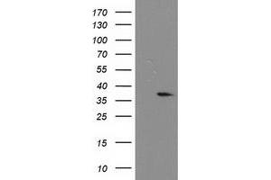Western Blotting (WB) image for anti-Nucleotide Binding Protein-Like (NUBPL) (AA 1-250) antibody (ABIN1490631) (NUBPL 抗体  (AA 1-250))
