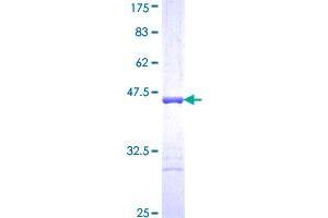 Titin Protein (TTN) (AA 1-110) (GST tag)