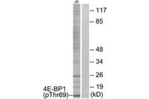 Western blot analysis of extracts from Jurkat cells treated with EGF 200ng/ml 30', using 4E-BP1 (Phospho-Thr69) Antibody. (eIF4EBP1 抗体  (pThr69))