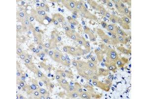 Immunohistochemistry of paraffin-embedded Human liver damage using RBP2 Polyclonal Antibody at dilution of 1:100 (40x lens). (RBP2 抗体)