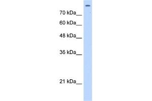 WB Suggested Anti-MATR3 Antibody Titration:  2. (MATR3 抗体  (C-Term))
