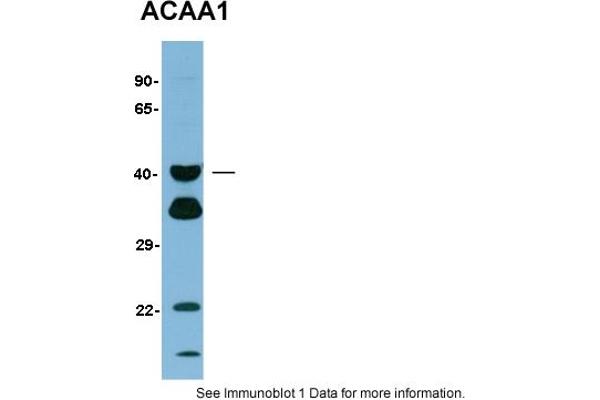 ACAA1 抗体  (N-Term)