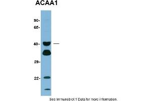 Sample Type: Human LiverPrimary Dilution: 1:1000Gel concentration: 12% (ACAA1 抗体  (N-Term))