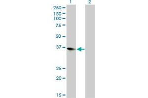 Western Blot analysis of ZFP36L1 expression in transfected 293T cell line by ZFP36L1 monoclonal antibody (M02), clone 1A3. (ZFP36L1 抗体  (AA 1-108))