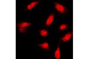 Immunofluorescent analysis of c-FER staining in HeLa cells. (FER 抗体  (C-Term))