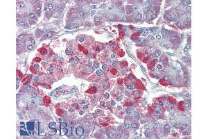 Immunohistochemistry (IHC) image for anti-Transient Receptor Potential Cation Channel, Subfamily M, Member 2 (TRPM2) (Internal Region) antibody (ABIN6391352)