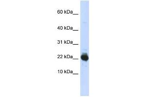 WB Suggested Anti-UBE2L3 Antibody Titration:  0. (UBE2L3 抗体  (Middle Region))