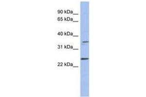 Image no. 1 for anti-Necdin Homolog (Mouse) (NDN) (AA 179-228) antibody (ABIN6744060) (NDN 抗体  (AA 179-228))