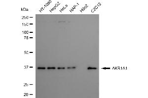 Western blotting analysis using AKR1A1 antibody (ABIN7797569).
