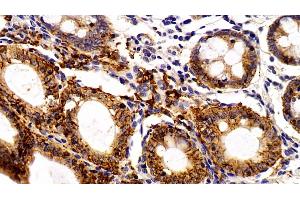 Detection of EPCAM in Porcine Colon Tissue using Polyclonal Antibody to Epithelial Cell Adhesion Molecule (EPCAM)