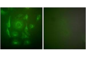 Immunofluorescence analysis of HepG2 cells, using Keratin 7 Antibody.