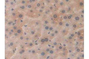 DAB staining on IHC-P; Samples: Mouse Liver Tissue (APP 抗体  (AA 672-711))
