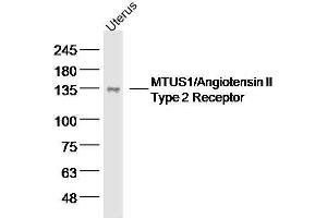 Mouse uterus lysates probed with MTUS1 Polyclonal Antibody, unconjugated  at 1:300 overnight at 4°C followed by a conjugated secondary antibody for 60 minutes at 37°C. (MTUS1 抗体  (AA 1151-1270))