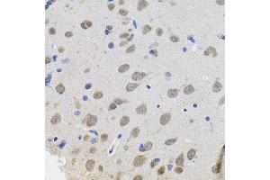 Immunohistochemistry of paraffin-embedded rat brain using VEPH1 antibody (ABIN5974616) (40x lens). (VEPH1 抗体)