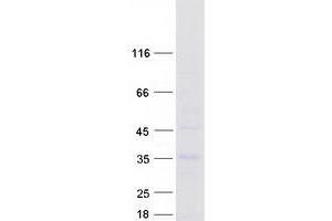 Western Blotting (WB) image for Linker For Activation of T Cells Family, Member 2 (LAT2) (Transcript Variant 2) protein (Myc-DYKDDDDK Tag) (ABIN2724516)