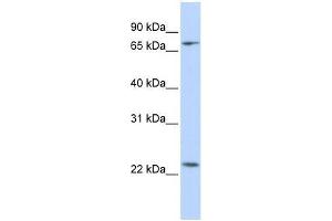 Western Blot showing ZNF185 antibody used at a concentration of 1-2 ug/ml to detect its target protein. (Zinc Finger Protein 185 抗体  (N-Term))