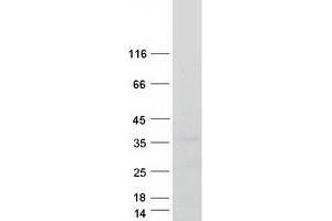 Western Blotting (WB) image for Phosphatidic Acid Phosphatase Type 2B (PPAP2B) (Transcript Variant 1) protein (Myc-DYKDDDDK Tag) (ABIN2729410)