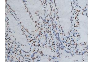 ABIN6267039 at 1/200 staining human colon tissue sections by IHC-P. (Histone 3 抗体)