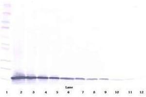 Image no. 1 for anti-Chemokine (C-C Motif) Ligand 21 (CCL21) antibody (ABIN465507) (CCL21 抗体)