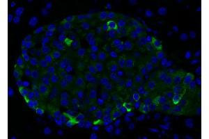 Immunohistochemistry (IHC) image for anti-Chromogranin B (Secretogranin 1) (CHGB) (AA 407-677) antibody (ABIN1742518) (CHGB 抗体  (AA 407-677))