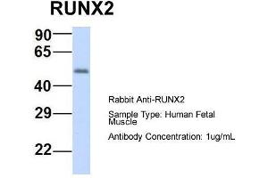 Host:  Rabbit  Target Name:  RUNX2  Sample Type:  Human Fetal Muscle  Antibody Dilution:  1.