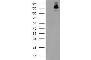 Western Blotting (WB) image for anti-Histone Deacetylase 6 (HDAC6) antibody (ABIN1498618) (HDAC6 抗体)