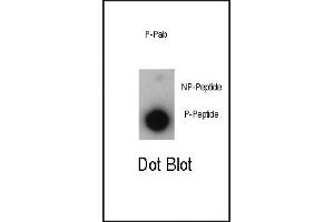Dot blot analysis of anti-Phospho-P21CIP1-T57 Antibody (ABIN389613 and ABIN2839617) on nitrocellulose membrane. (p21 抗体  (pThr57))