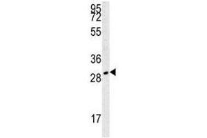 TPSAB1 antibody western blot analysis in 293 lysate. (TPSAB1 抗体  (AA 61-87))