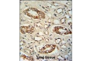M1L antibody (C-term) (ABIN654954 and ABIN2844594) immunohistochemistry analysis in formalin fixed and paraffin embedded human lung tissue followed by peroxidase conjugation of the secondary antibody and DAB staining. (PPM1L 抗体  (C-Term))