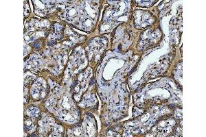 IHC analysis of Annexin A10/ANXA10 using anti-Annexin A10/ANXA10 antibody (ABIN7601853). (Annexin a10 抗体  (AA 49-324))