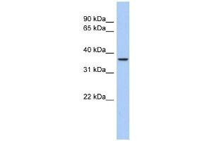 Aquaporin 10 antibody used at 1 ug/ml to detect target protein. (Aquaporin 10 抗体  (Middle Region))