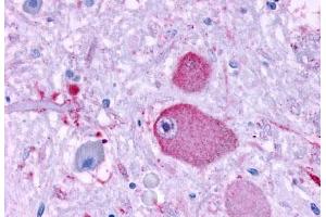 Anti-GPR37 antibody  ABIN1048808 IHC staining of human brain, neurons and glia. (GPR37 抗体  (N-Term))