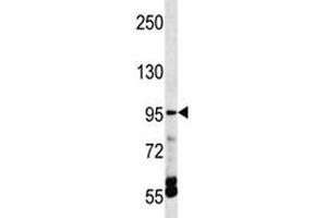 TRPV5 antibody western blot analysis in HepG2 lysate. (TRPV5 抗体  (AA 634-663))