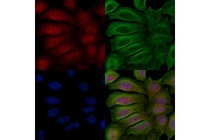 ABIN6256394 and ABIN6267617 staining Hela cells(20 min of 30uM Forskolin treatment) by IF/ICC. (PKC delta 抗体  (pSer645))