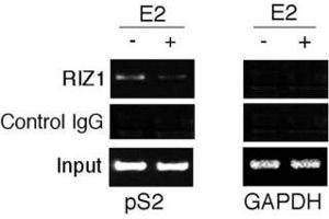 ChIP analysis: soluble chromatin was prepared from MCF7 cells treated/untreated with E2 for 45 min.