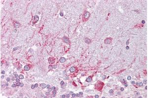 Immunohistochemistry with Brain, cerebellum tissue at an antibody concentration of 5µg/ml using anti-PSEN1 antibody (ARP44201_P050) (Presenilin 1 抗体  (N-Term))