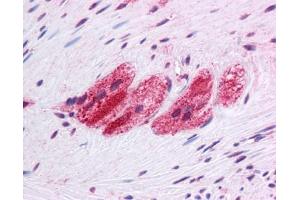 SEPN1 antibody was used for immunohistochemistry at a concentration of 4-8 ug/ml. (SEPN1 抗体  (C-Term))
