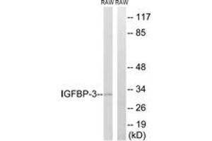 Western Blotting (WB) image for anti-Insulin-Like Growth Factor Binding Protein 3 (IGFBP3) (AA 151-200) antibody (ABIN2888880)