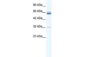 WB Suggested Anti-ZNF491 Antibody Titration:  0. (ZNF491 抗体  (N-Term))
