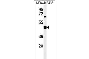SH2D2A Antibody (Center) (ABIN651523 and ABIN2840277) western blot analysis in MDA-M cell line lysates (35 μg/lane). (SH2D2A 抗体  (AA 86-112))