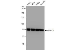 WB Image GRP75 antibody detects GRP75 protein by western blot analysis. (HSPA9 抗体  (Center))