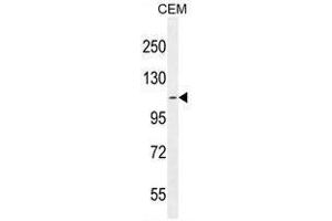 AT8B2 Antibody (N-term) western blot analysis in CEM cell line lysates (35µg/lane). (ATP8B2 抗体  (N-Term))