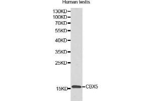 Western Blotting (WB) image for anti-Lysozyme-Like 6 (LYZL6) (AA 20-148) antibody (ABIN3021348) (LYZL6 抗体  (AA 20-148))