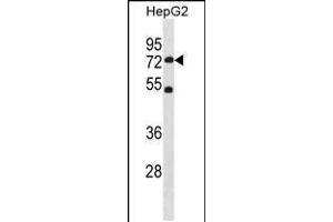 Western blot analysis in HepG2 cell line lysates (35ug/lane). (SETD3 抗体  (C-Term))