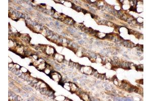 IHC analysis of IDH2 using anti-IDH2 antibody .