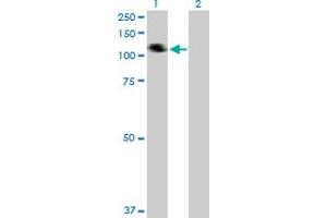 Western Blotting (WB) image for anti-Collagen, Type XXI, alpha 1 (COL21A1) (AA 1-957) antibody (ABIN529361)